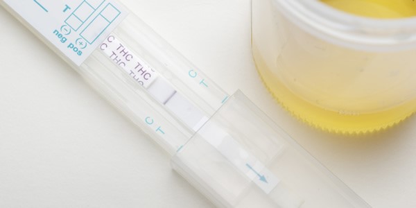 Synthetic Urine With Uric 
      Acid Mesa View Cortez CO